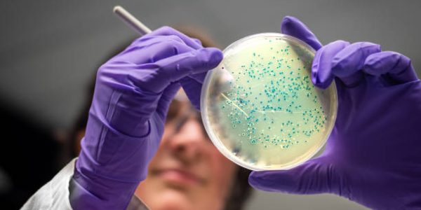 Bacterial culture plate examination by a female researcher in microbiology laboratory